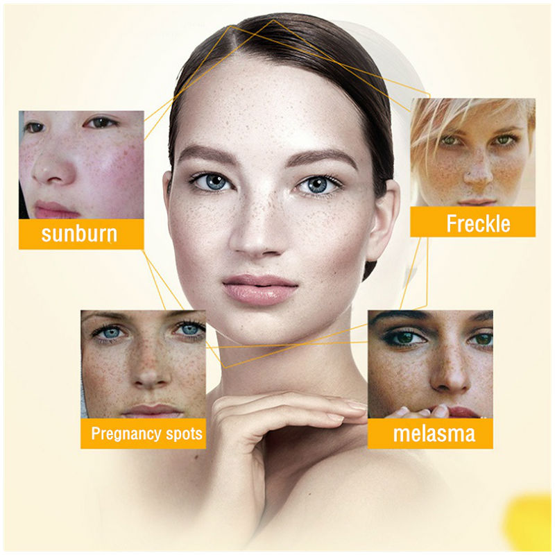 Dimollaure Whitening Freckle C - Skincare Herbal review and price