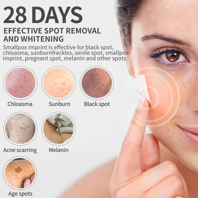 Dimollaure Whitening Freckle C - Skincare Herbal review and price